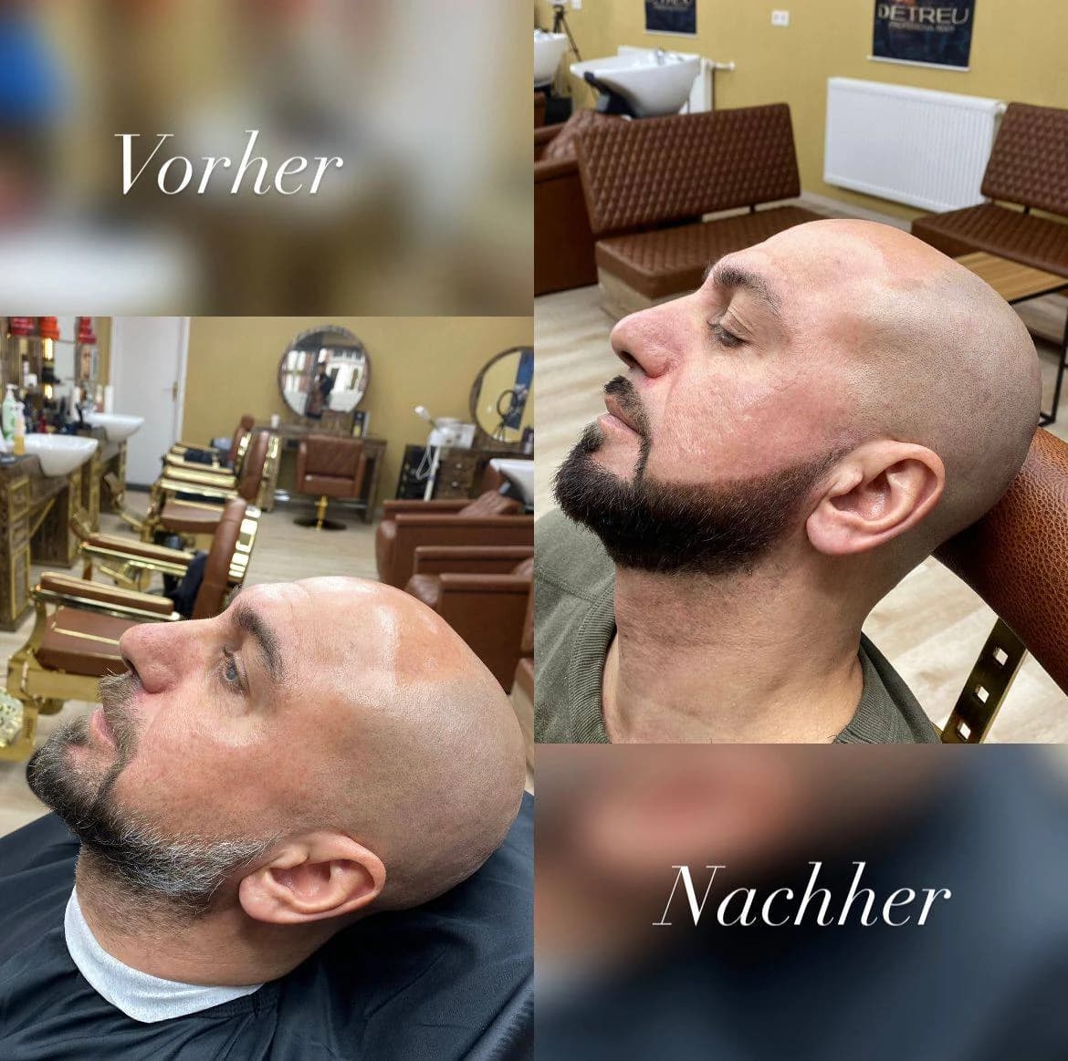 Vorher-Nachher-Ansicht einer sauberen Bartkontur